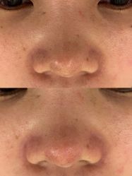 体验前-Flawless skin法思轻奢美肌