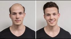 -发饰美男士增发补发假发定制店