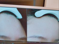 -苑苑vbeauty科技美容SPA