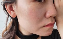 -北京米扬丽格医疗美容·联合丽格鼻整形中心