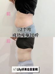 -Lily纤美·科技减脂中心