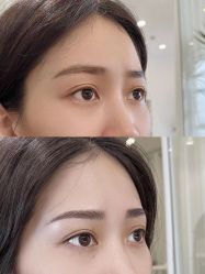 点击看大图 -张小野·专业半永久纹眉