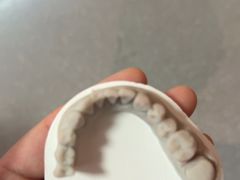 -上海仁爱医院口腔科 · 种植