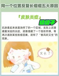 -苗方清颜痘肌研究所