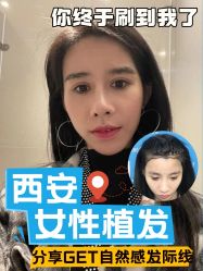 -雍禾植发全国连锁