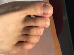 -世龙世家灰指甲鸡眼脚气甲沟炎跖疣护理(通州店)