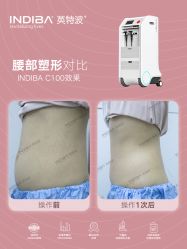 -半岛故事·法儿曼抗衰·indiba中心
