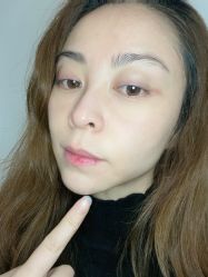 -洁铭新加坡医美