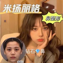 -北京米扬丽格医疗美容·联合丽格鼻整形中心
