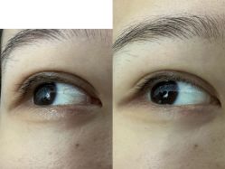 点击看大图 -瓷肌博士·祛痘科技美肤