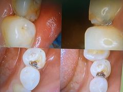 -爱贝口腔·牙周诊疗·种植修复中心