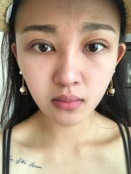 -美莱医学美容医院