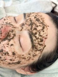 -清颜堂丨分子祛痘·功效美肤