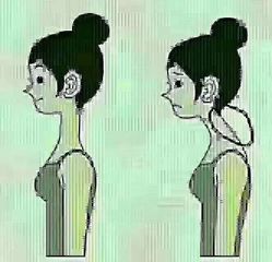 -FACE·日本小颜美容整骨