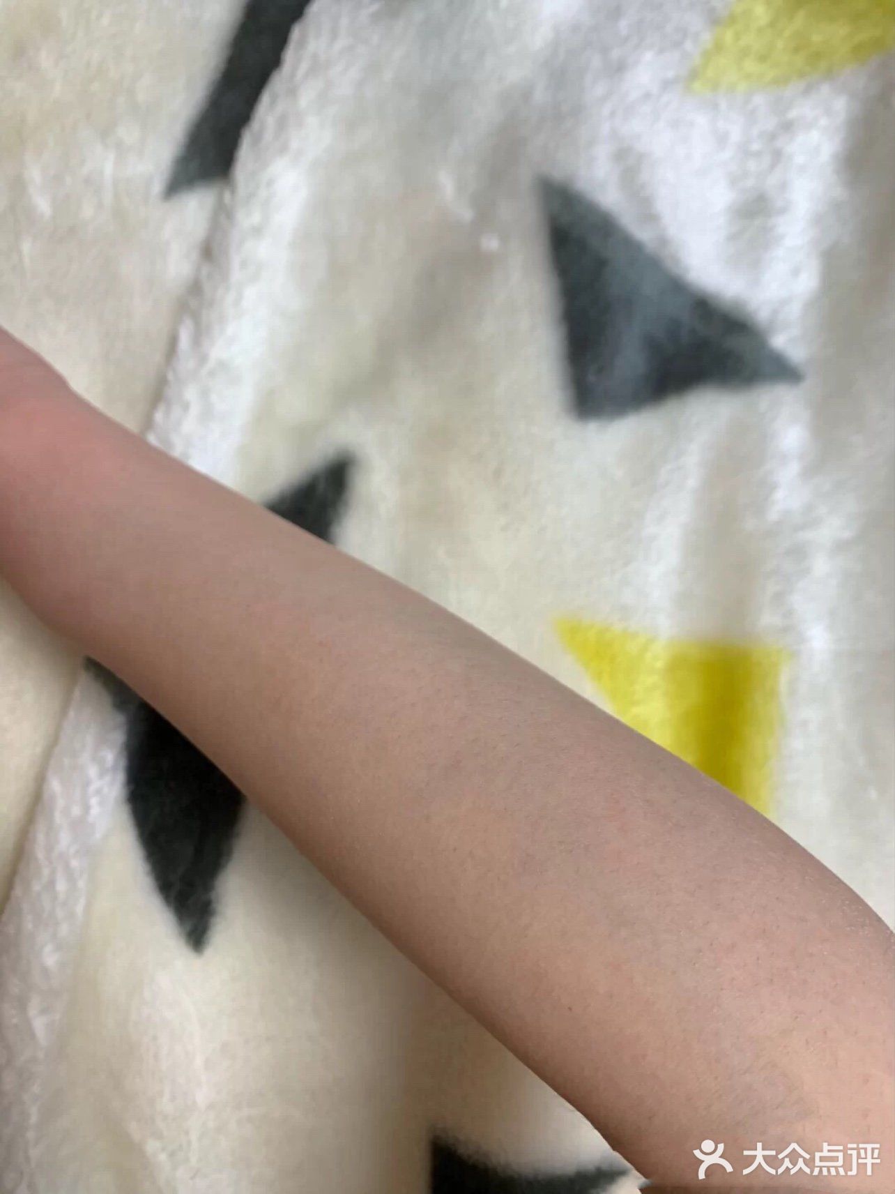 脱毛后光滑的手臂再也不会吓到小伙伴哦