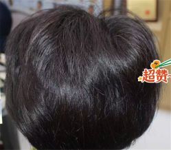 -大麦微针植发全国连锁