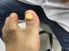 -新甲连锁灰指甲·甲沟炎·鸡眼(黑龙江路店)