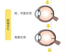 -星视野儿童近视弱视视力训练中心(富荟店)
