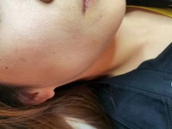 -清疣美疣·痣·斑净肤中心