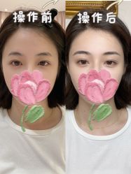 -UP&UP·半永久眉毛眼线机器野生眉