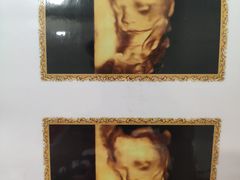 -伊丽莎白妇科医院·早孕检查