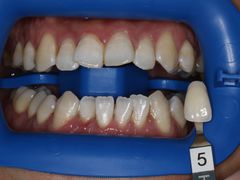 -齐玉齿科JADENTAL