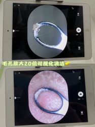 -凡碧诗毛孔清洁收细