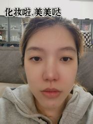 -广州健丽·去眼袋医疗美容机构