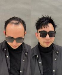 -唐风采假发补发定制