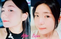 点击看大图 -SKINIST丽铂医疗美容