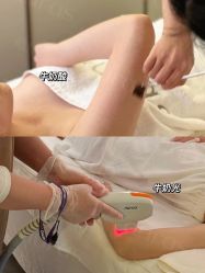 点击看大图 -AURAS璈然科技护肤中心
