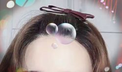 -大麦微针植发全国连锁