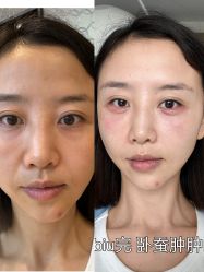 -四川娇点医学美容医院