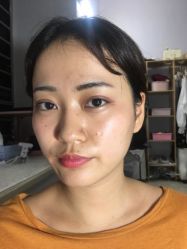 -广东韩妃整形外科医院