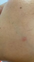 体验后-南宁华美医疗美容医院