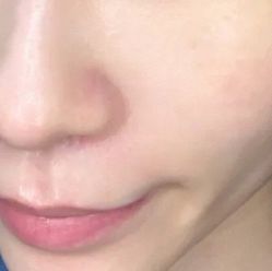 体验后-上海玫瑰医疗美容医院