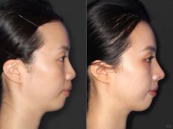 -上海伊莱美医疗美容医院