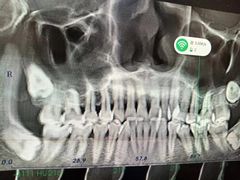 -同步齿科·数字化正畸种植口腔中心(珠海店)