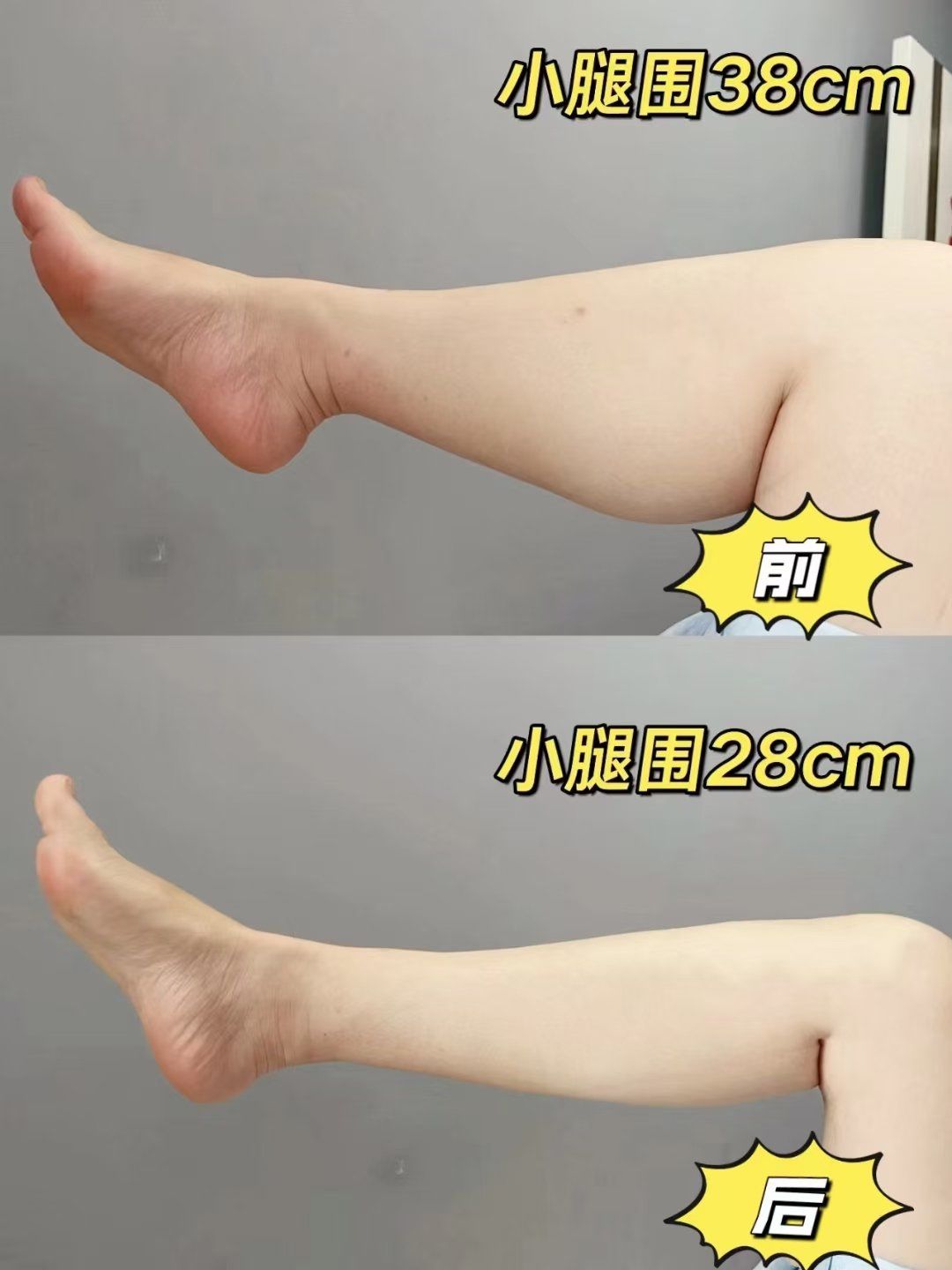 瘦腿神器
​v塑.9d炸脂王
