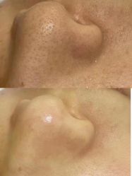 体验前-肌芙初定制皮肤管理中心