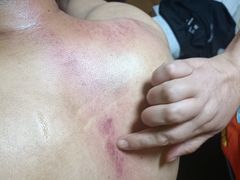 -沈师傅盲人按摩工作室(密三小区店)