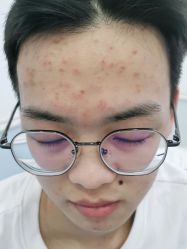 -蕾特恩专业祛痘·皮肤管理