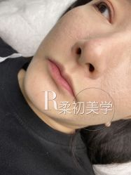 -RC半永久纹眉纹发际线