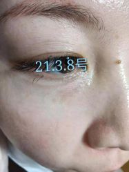 -美人痣全国连锁