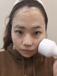 体验后-顾泽医疗美容