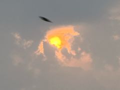 -黑马眼科·近视手术