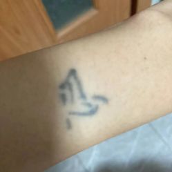 点击看大图 -天道专业洗纹身