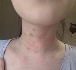 -恒妍医美·韩国定制抗衰中心