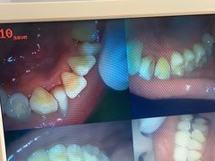 -赫尔森口腔·牙齿种植修复