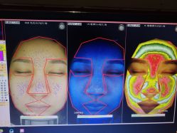 皮肤诊断-光SPA科技美肤